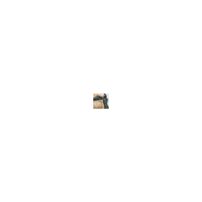 North_American_Rescue-linecard_North_American_Rescue_SPEAR__Simplified_Pneumothorax_Emergency_Air_Release_-03.jpg